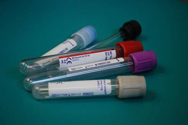 Ordering Blood Tests Online
